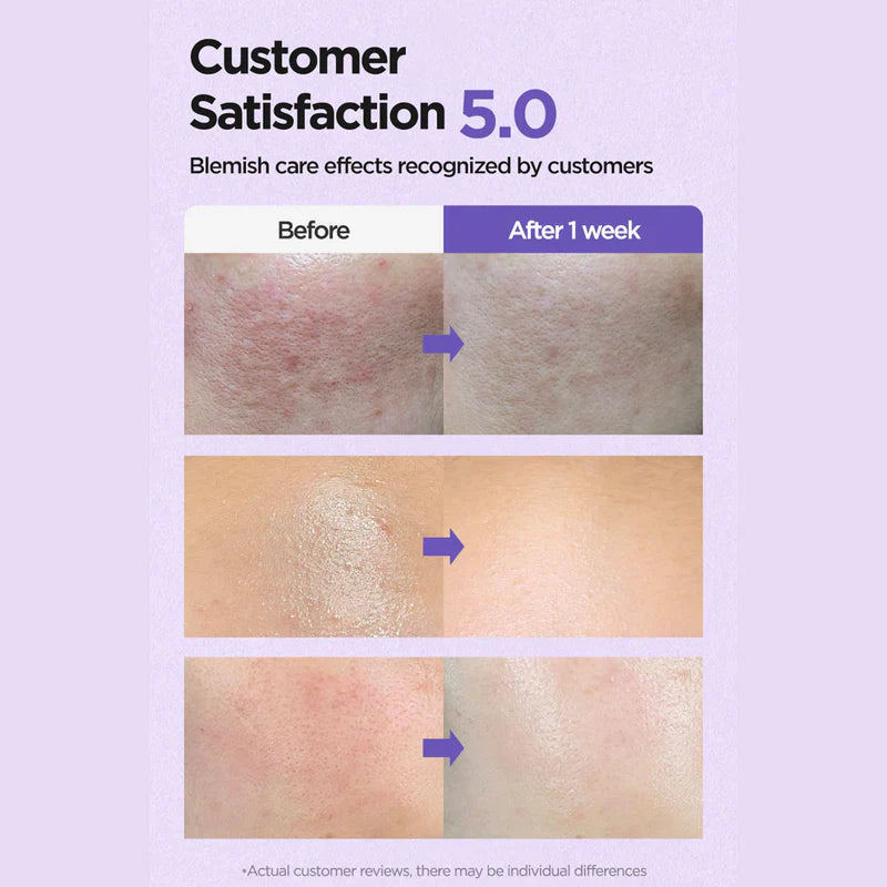 ISNTREE Onion Newpair Clear Pad 60 Pads 250ml