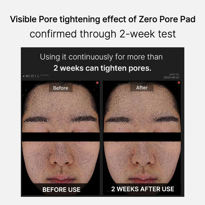 Medicube Zero Pore Pad 2.0 70p