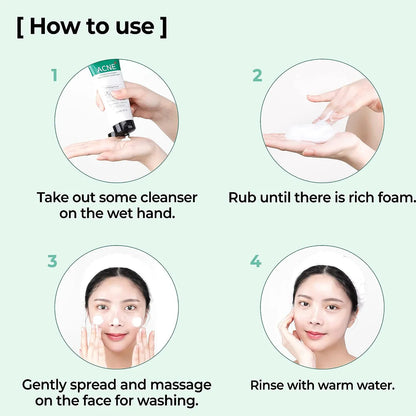 SOMEBYMI AHA BHA PHA 30 Days Miracle Acne Clear Foam 100ml