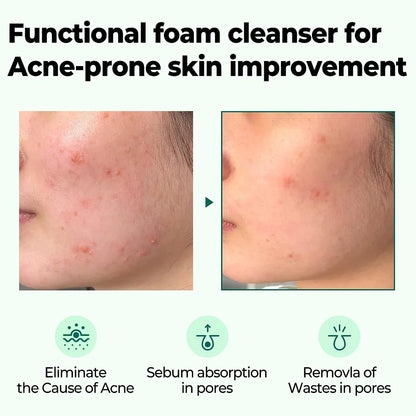 SOMEBYMI AHA BHA PHA 30 Days Miracle Acne Clear Foam 100ml