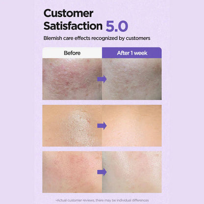 ISNTREE Onion Newpair Clear Pad 60 Pads 250ml